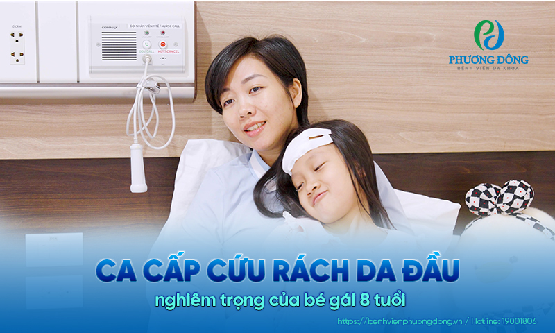 Ca cấp cứu rách da đầu nghiêm trọng của bé gái 8 tuổi  