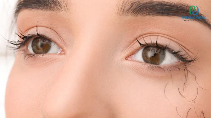 Thiếu dưỡng chất có thể khiến lông mi rụng nhanh và lâu mọc lại