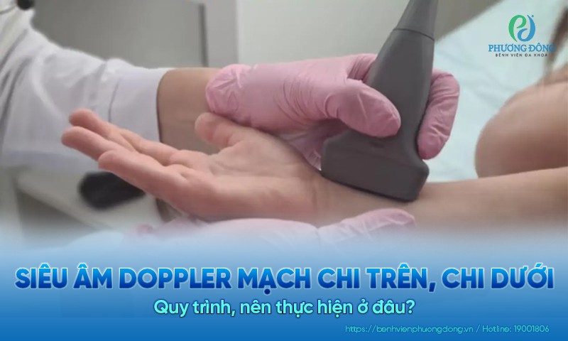 Siêu âm Doppler mạch chi trên, chi dưới: Quy trình, nên thực hiện ở đâu?