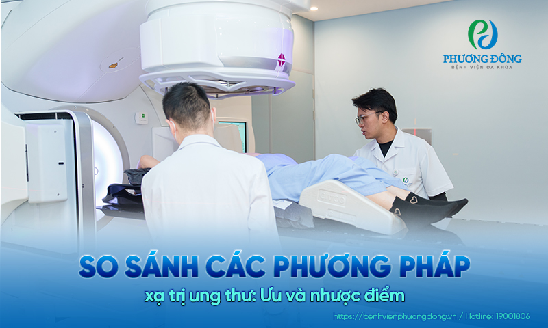 So sánh các phương pháp xạ trị ung thư: Ưu và nhược điểm 