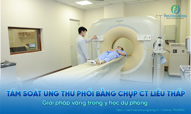 Tầm soát ung thư phổi bằng chụp CT liều thấp (LDCT): Giải pháp vàng trong y học dự phòng 