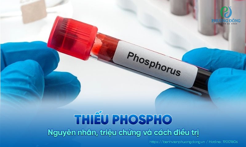 Thiếu phospho: Nguyên nhân, triệu chứng và cách điều trị