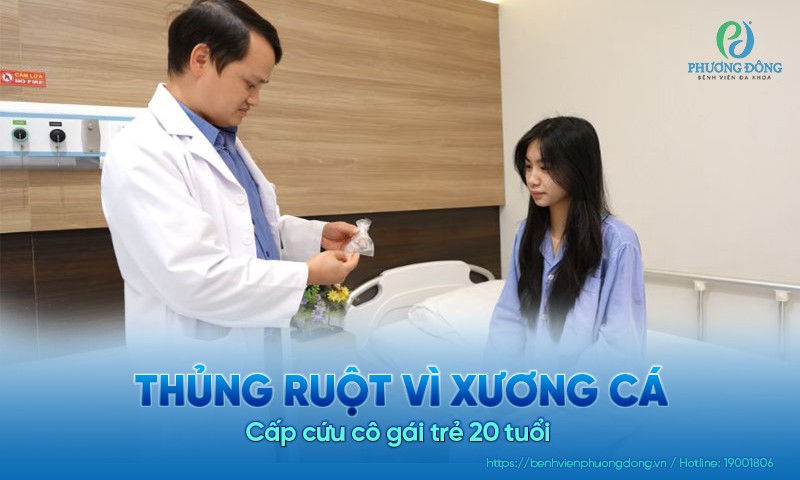 Cấp cứu cô gái trẻ 20 tuổi bị thủng ruột vì xương cá