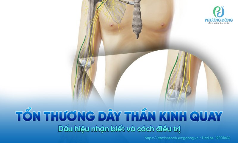Tổn thương dây thần kinh quay: Dấu hiệu nhận biết và cách điều trị