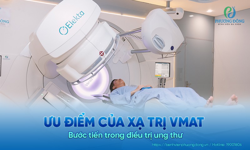 Ưu điểm của xạ trị VMAT - Bước tiến trong điều trị ung thư