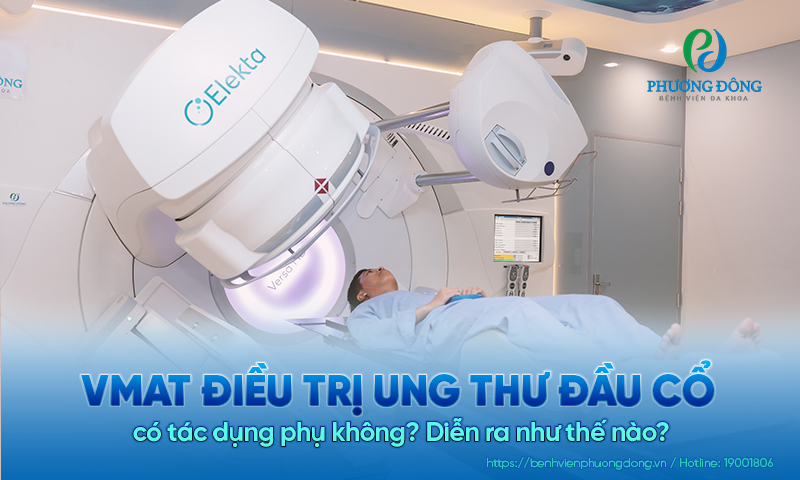 VMAT điều trị ung thư đầu cổ có tác dụng phụ không? Diễn ra như thế nào?