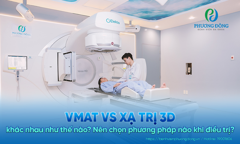 VMAT vs xạ trị 3D khác nhau như thế nào? Nên chọn phương pháp nào khi điều trị?