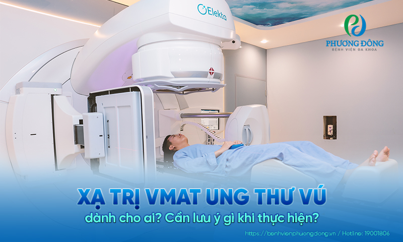 Xạ trị VMAT ung thư vú dành cho ai? Cần lưu ý gì khi thực hiện?