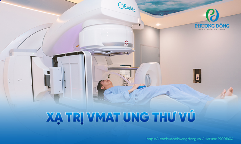 Xạ trị VMAT là kỹ thuật xạ trị ngoài hiện đại, dành cho các ca cần xạ trị diện rộng nhưng vẫn phải bảo vệ các mô lành xung quanh