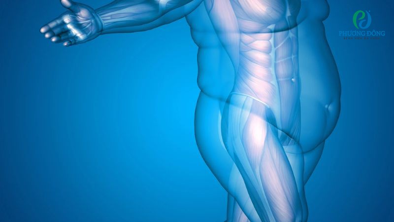 Hỏi đáp bác sĩ Dinh dưỡng: Béo phì có nguy hiểm không?