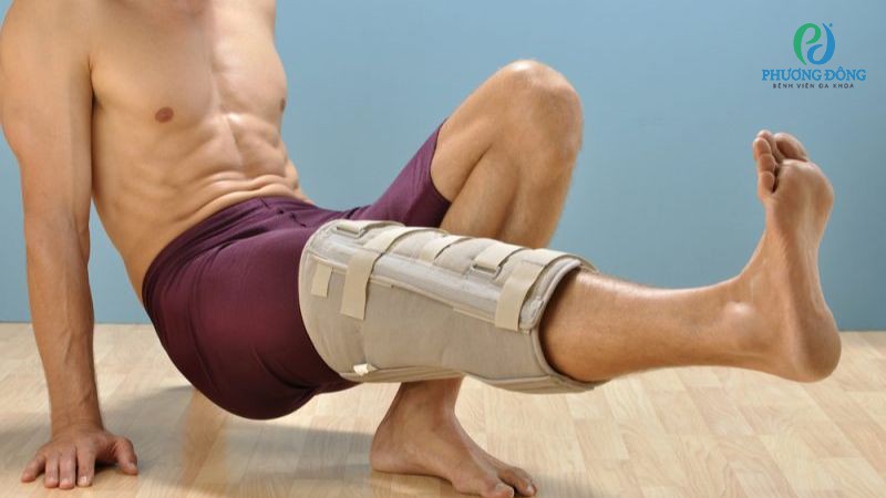 Bác sĩ Cơ Xương Khớp trả lời: Đứt dây chằng chéo trước có đi được không?