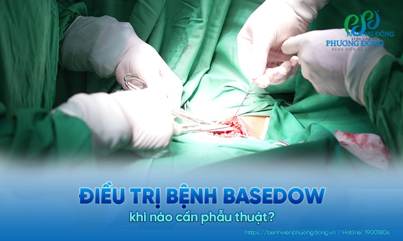 Điều trị bệnh Basedow khi nào cần phẫu thuật? Nguy cơ có thể gặp phải