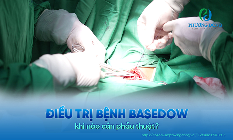 Điều trị bệnh Basedow khi nào cần phẫu thuật? Nguy cơ có thể gặp phải
