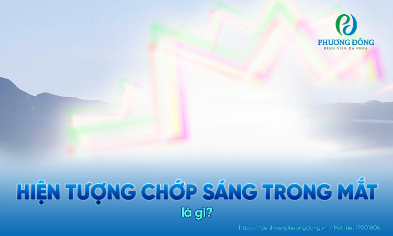 Hiện tượng chớp sáng trong mắt: Biểu hiện, nguyên nhân và điều trị