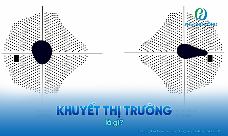 Khuyết thị trường là gì? Nguyên nhân và các dạng khiếm khuyết thị trường
