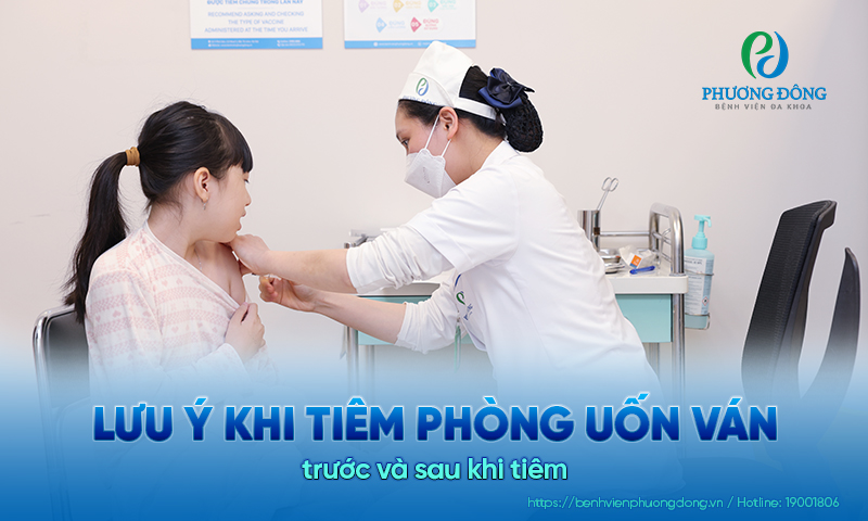 Lưu ý khi tiêm phòng uốn ván cần biết để giảm tác dụng phụ