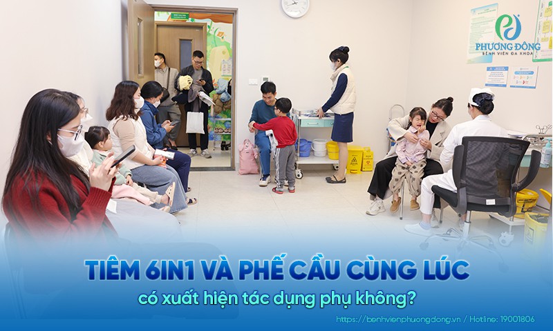 Có nên tiêm 6in1 và phế cầu cùng lúc không? Phác đồ tiêm phù hợp