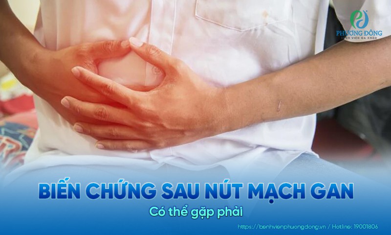 Một số biến chứng sau nút mạch gan có thể gặp phải