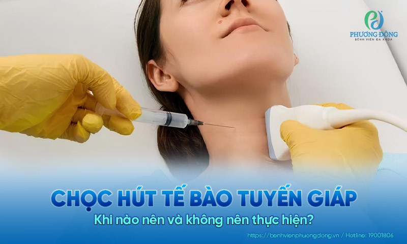Chọc hút tế bào tuyến giáp: Khi nào nên và không nên thực hiện?