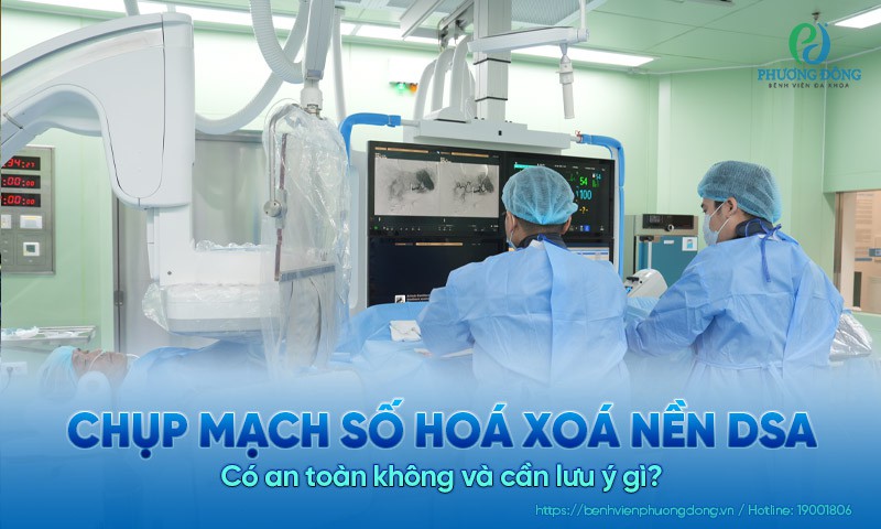 Chụp mạch số hoá xoá nền DSA: Có an toàn không và cần lưu ý gì?
