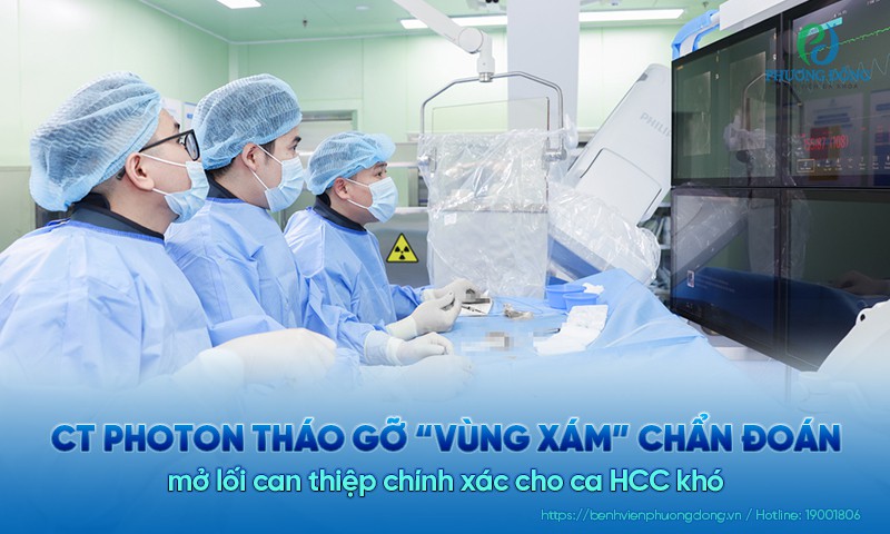 CT Photon tháo gỡ “vùng xám” chẩn đoán, mở lối can thiệp chính xác cho ca HCC khó