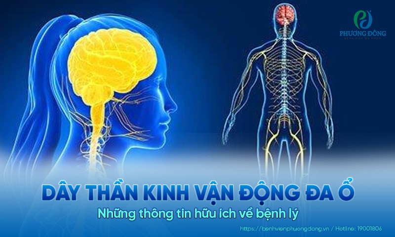 Tìm hiểu về bệnh lý dây thần kinh vận động đa ổ