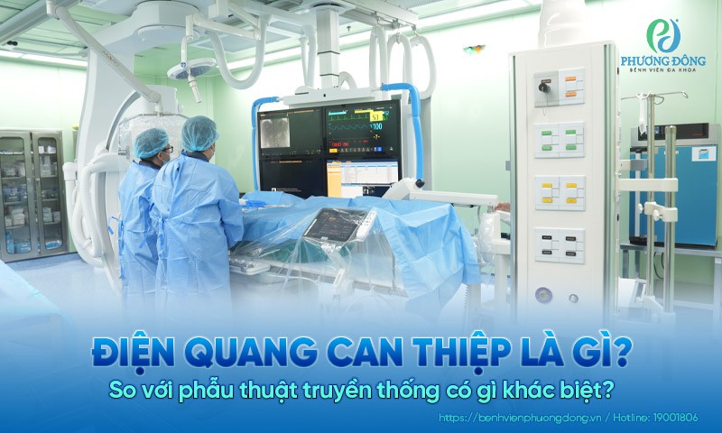 Điện quang can thiệp là gì và khác gì so với phẫu thuật truyền thống?