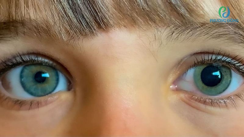 Kích thước con ngươi có thể thay đổi theo điều kiện môi trường ánh sáng