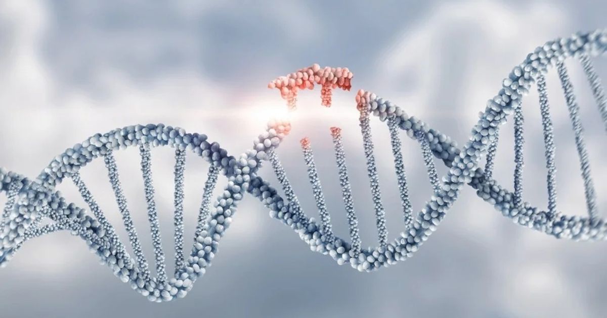 Đột biến gen là nguyên nhân chính gây ra hội chứng Leber