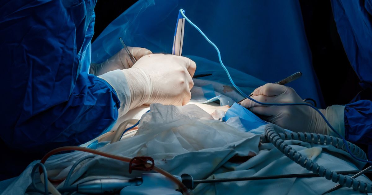 Đốt điện là một trong số các phương pháp can thiệp để điều trị gai sinh dục 