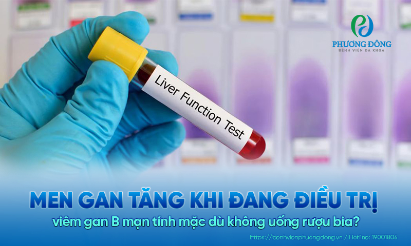 Men gan tăng khi đang điều trị viêm gan b mạn tính mặc dù không uống rượu bia?