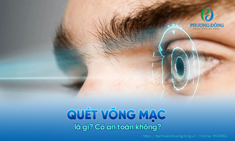 Quét võng mạc là gì? Có an toàn không?