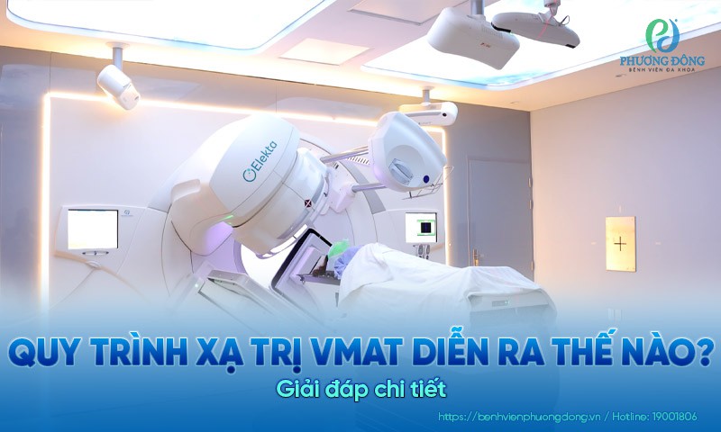 Giải đáp chi tiết: Quy trình xạ trị VMAT diễn ra thế nào?