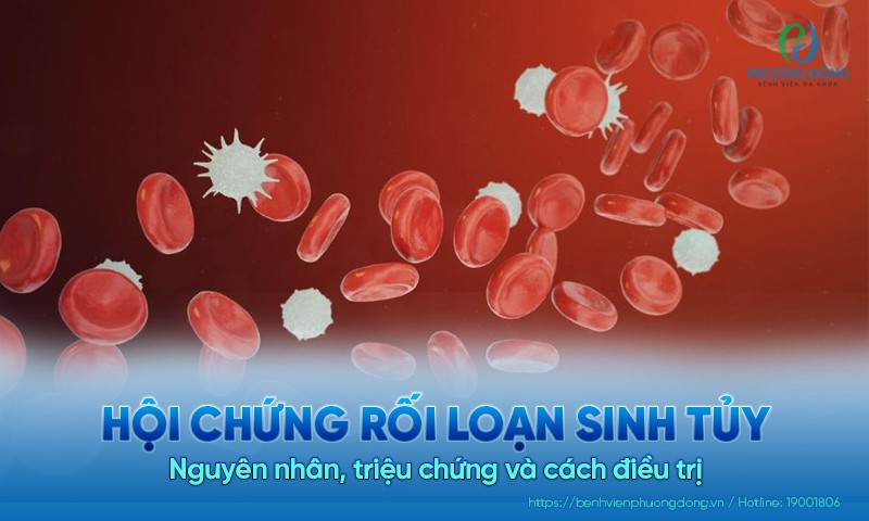 Hội chứng rối loạn sinh tủy: Nguyên nhân, triệu chứng và cách điều trị