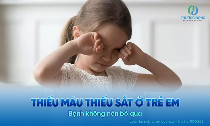 Thiếu máu thiếu sắt ở trẻ em - Bệnh không nên bỏ qua