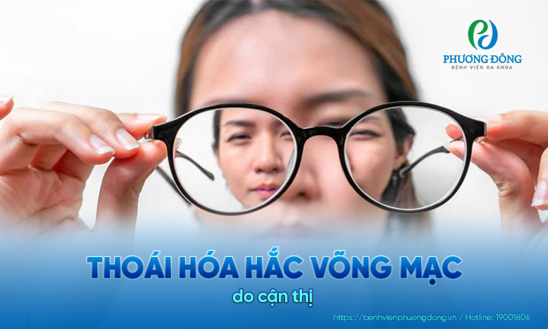 Người bị cận thị lâu năm có lớp võng mạc mỏng, dễ bị tổn thương, thậm chí thoái hóa sớm