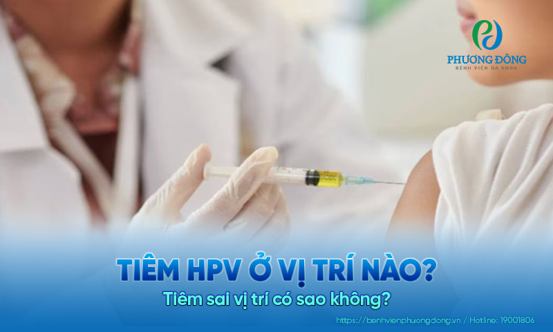 Tiêm HPV ở vị trí nào? Tiêm sai vị trí có sao không? 