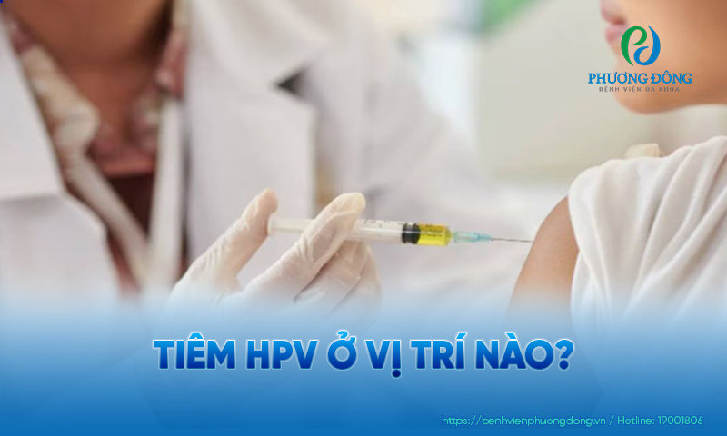 Vị trí tiêm HPV tiêu chuẩn là tiêm bắp