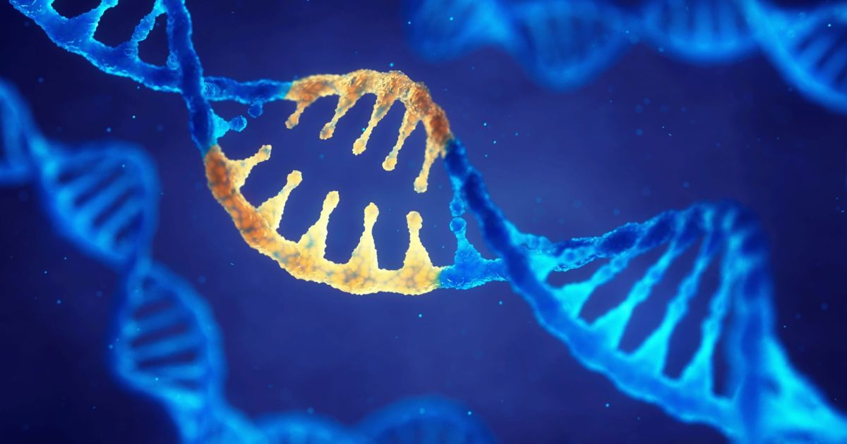 Các bất thường về mặt di truyền có thể là nguyên nhân gây ra bệnh lý này