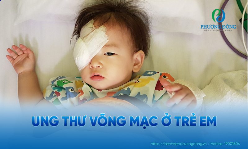 Bệnh này thường gặp ở trẻ em dưới 5 tuổi