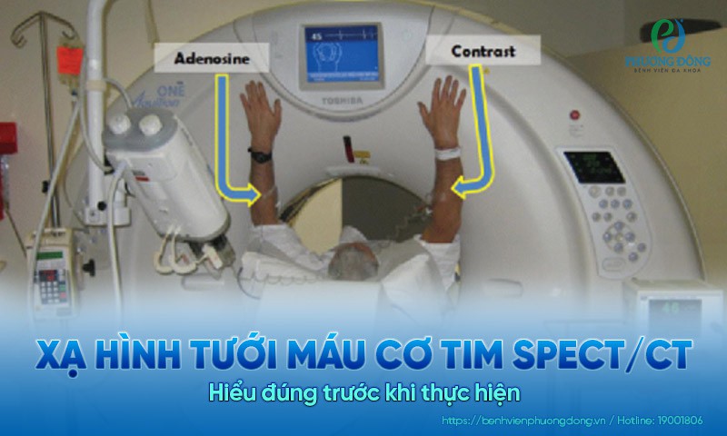 Hiểu đúng về xạ hình tưới máu cơ tim SPECT/CT trước khi thực hiện 