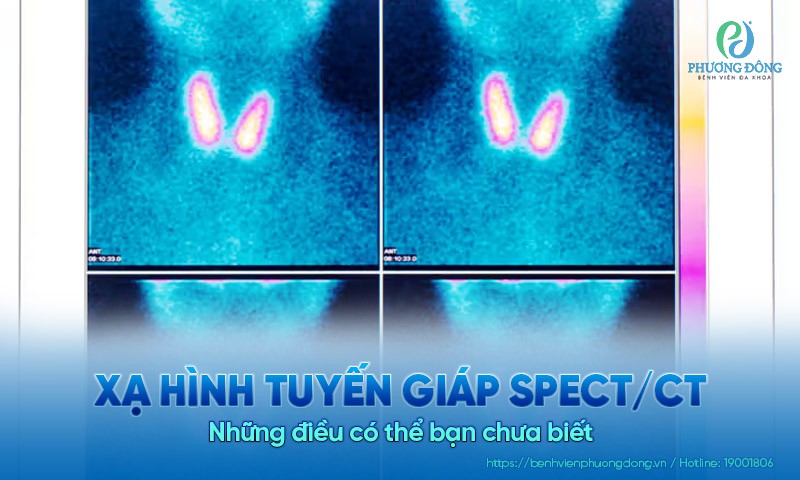Xạ hình tuyến giáp SPECT/CT: Những điều có thể bạn chưa biết
