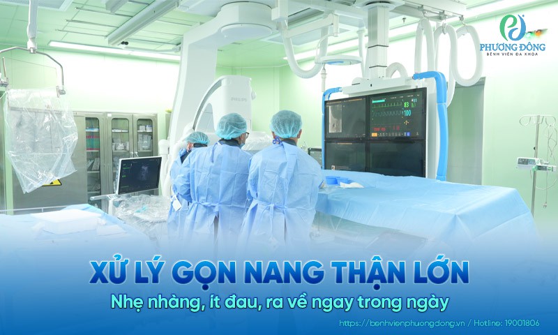 Xử lý gọn nang thận lớn – Nhẹ nhàng, ít đau, ra về ngay trong ngày