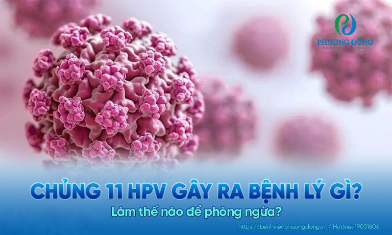 Chủng 11 HPV gây ra bệnh lý gì? Làm thế nào để phòng ngừa?