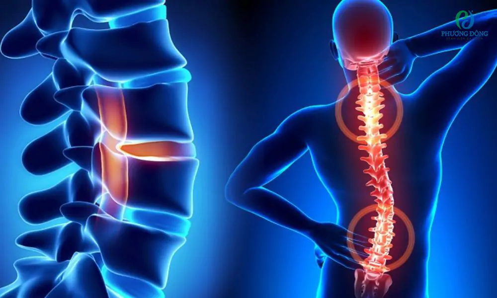 Chấn thương tủy sống: Tế bào gốc có thể được ứng dụng thế nào?