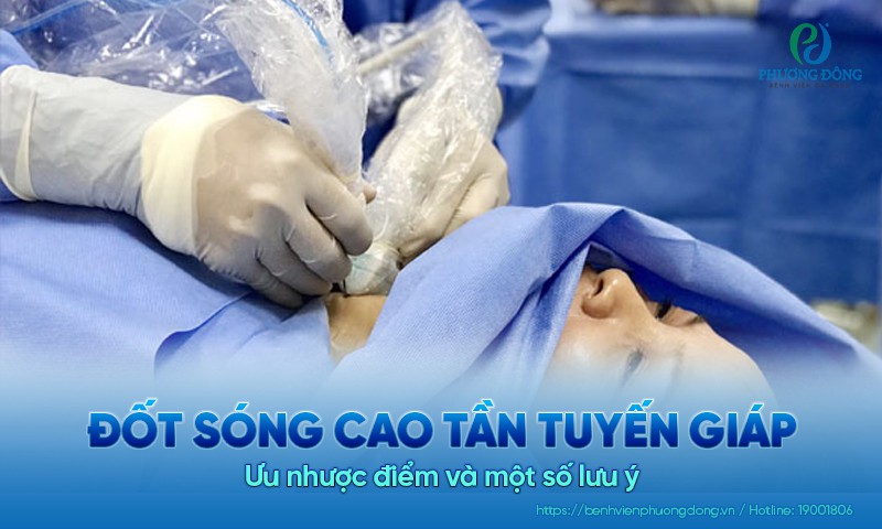 Đốt sóng cao tần tuyến giáp: Ưu nhược điểm và một số lưu ý