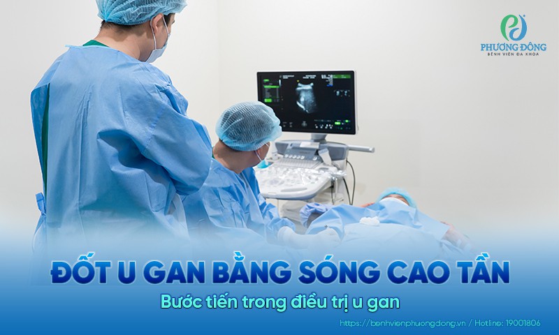 Đốt u gan bằng sóng cao tần: Bước tiến trong điều trị u gan