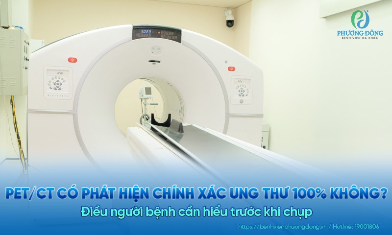PET/CT có phát hiện chính xác ung thư 100% không? Điều người bệnh cần hiểu trước khi chụp