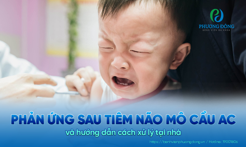 Phản ứng sau tiêm não mô cầu AC và hướng dẫn cách xử lý tại nhà