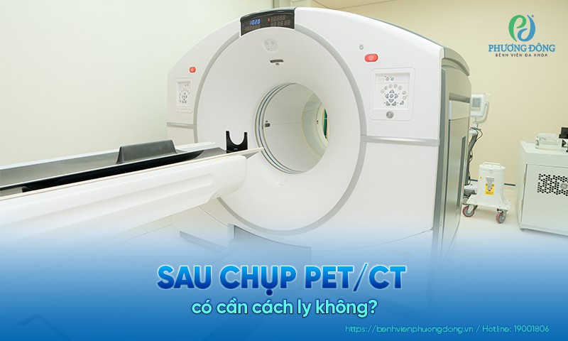Sau chụp PET/CT có cần cách ly không?